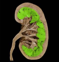 Renal medulla
Deep layer of the kidney
 
Contains two parts:
 Renal columns
 Renal pyramids