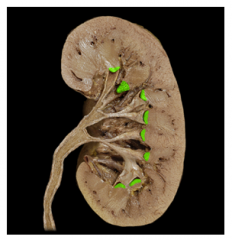 What part of the kidney is this structure in?
What are these structure called?  What are they and what do they do?