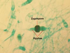 thick-walled sexual spores made by zygomycetes

Lab Module 3: Fungi
