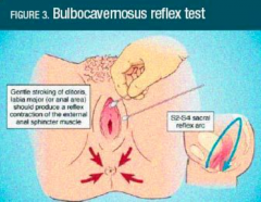 1.  Bulbocavernosus reflex test