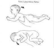 (TLR) Tonic Labyrinthine reflex