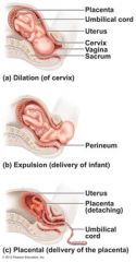 expulsion 

the time from full dilation of the cervix to delivery of the infant. In this stage, the infant passes through the cervix and vagina to the outside of the body. During this stage, a mother experiencing natural childbirth has an increa...