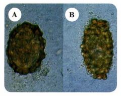 ¿Cómo se llaman los huevos de ascaris que vienen de hembras no fecundadas y suelen tener una sola membrana?


 


Diga a qué letra de la imagen corresponden. 