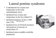 SST (pain & temp body contra), ipsa pain & temp face, ipsa paralysis of face (LMN type) - VII, ipsa ataxia (MCP), face sensation & mastication (V)