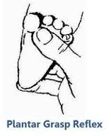 28 weeks to 9 months
Stimulus: Pressure at base of toes
Response: Toe flexion