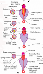 - Under androgen influence, the perineal area of the male embryo elongates
- Labiosacral swellings fuse ventrally forming the scrotum
- Inferior or caudal end of the gubernaculum is attached to the labioscrotal swellings
- Testis enters the scr...