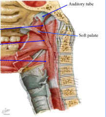 salpingo- auditory tube above superior constrictor to pharynx
palato- from soft palate to pharynx
lift pharynx
