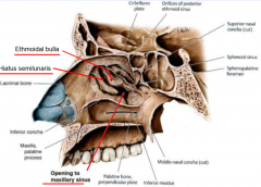 bulge created by ethmoidal sinuses
hiatus semilunaris below it
opening to maxillary sinus inferoposterior