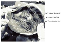 Chordae tendonae: bundles of collagen fibres that arise form papillary muscle to limit movement of cusps and prevent backflow of blood.


On mitral and tricuspid valves in ventricles.