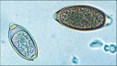 Identify these two eggs from a dog's fecal sample