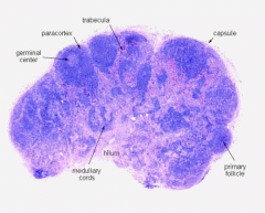 Trabeculae around each primary follicle(made of B Cells).  Afferent Lymphatic Vessel on convex(rounded) portion of lymph node.Clear areas near primary nodules are germinal centers where B Cells are being produces.