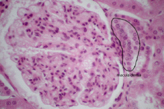 cluster of cells in the juxtaglomerular complex


near the DCT
