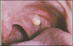 Describe this lesion and give differential diagnoses.