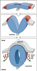 1) Formation of a neural plate in the ectoderm located above notochord. 2) The edge of the neural plate forms neural folds which rise towards midline.

3) The folds fuse to form neural tube.

4) At tube closure, the cells at the junction form ne...