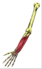 O:  Humeroulnar head:  medial humeral epicondyle and medial       border of coronoid process
     Radial head:  upper part of anterior border of radius

I:  4 tendons – base of middle phalanx of digits 2-5

A:  Flexes middle phalanges (PIP)...