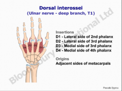 O:  Between metacarpal bones
I:  2 are on the 3rd digit, 1 on the 2nd, 1 on the 4th
A:  (DAB) Abduction of the 2nd, 3rd, and 4th digits and assist in flexion of MP joint and extension of PIP and DIP joints
Nerve:  Ulnar nerve