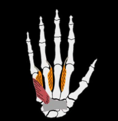 O:  Between metacarpal bones
I:  NONE on 3rd digit, 1 on 2nd, 4th and 5th
A:  (PAD) Adduction of 2nd, 4th and 5th digit and assist with flexion of MP and extension of PIP and DIP joints
Nerve: Ulnar