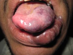 Describe this lesion and give differential diagnoses.