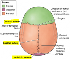 -Coronal: frontal and parieal
-Sagittal: two parietal bones
-Lambdoid: parietal and occipital
-Squamos: temporal and parietal