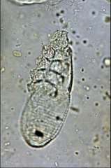 - small, cigar shaped mites- usually in hair follicles and sebaceous glands
- vermiform shaped with long, transversely striated abdomen and short stubby legs
- most species are non or mildly pathogenic
- generally very host specific