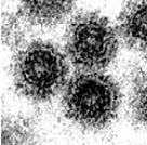 Describe. 
a. Caliciviridae b. Corona viridae c. Flaviviridae d. Picornaviridae e. Retroviridae f. Togavirus g. Arenavirus h. Bunyavirus i. Orthomyxovirus j. Filovirus k. Paramyxovirus l. Rhabdovirus m. lentivirus n. oncovirus o. norwalk virus p...