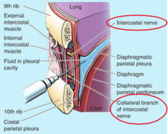 7th, 9th, OR 10th intercostal space
wherever you feel comfortable counting ribs

Avoid diaphragm and point needle UPWARDS when taking pleura out of pleural cavity****
