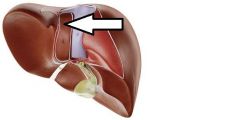Caudate lobe of liver