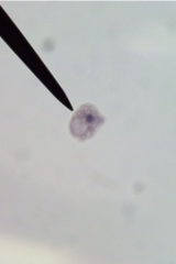 contact with amoeba in contaminated soil or watercyst