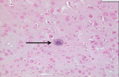 ingestion of cyst
mother to fetus
oocyst
D-feline