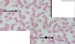 red blood cells