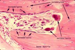 osteoblasts: make bone


osteoclasts: destroy bone


osteocytes: bone cells