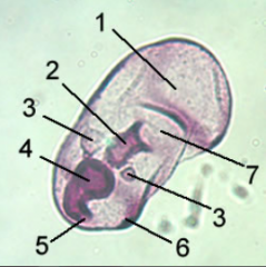 Early Bipinarria Larva