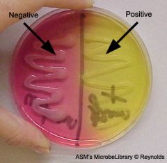 -selective and differential


-determine if bacteria can ferment sugar mannitol while in presence of 7% NaCl salt (is the bacteria halogenphile?)

-yellow = positive for mannitol fermentation 

-pink = negative for mannitol fermentation 