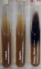 -converting esculin to esculetin.


-black= positive result


-esculetin reacts with ferric citrate.  