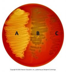 A: Beta

B: Alpha

C: Gamma


 


Streptococcus produce enzymes that lyse RBC