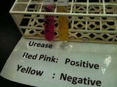 -it is a differential test (ph indicator phenol red), to see if bacteria can hydrolyze urea with enzyme urease.

-positive = dark purple due to ammonia production


-negative = yellow 