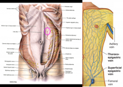 The superficial epigastric vein (femoral)
& the lateral thoracic vein (axillary vein)
form the thoracoepigastric vein
OR
The inferior epigastric vein (external iliac)
& the superior epigastric vein (brachiocephalic)
within the rectus sheath
...