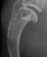 What lesion is seen in this bone (general category). What types are common in bone?