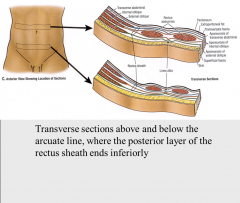 above:
internal oblique aponeruosis splitting to contribute to both anterior & posterior layers
below:
all 3 aponeurosis pass anterior to rectus abdominis, posterior surface contacts transversalis fascia