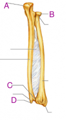 Which is the styloid process of the Ulnar?
A. a
B. b
C. c
D. d