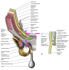 anterior wall: external oblique aponeurosis, reinforced laterally by internal oblique aponeurosis
posterior wall: transversalic fascia, reinforced by conjoint tendon
roof: arching fibers of internal oblique & transversus abdominis
floor: inguin...