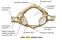 -C1
- lies between the cranium and the axis vertebrae 
- atlas lacks a vertebral body, a spinous process, and has no articulating discs 