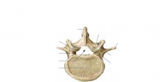 Namnge dessa delar på vertebrae (superiort)