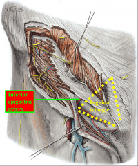 laterally- inferior epigastric artery
medially- rectus abdominus
inferiorly- inguinal ligament, reinforced posteriorly by iliopubic tract (transversalic fascia)