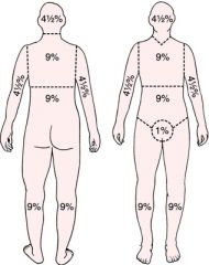 Can be used to determine the total percentage of area burned for each major section of the body.