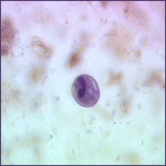 What is the name of the diagnostic characteristic of the Protozoa in the center of the cyst?