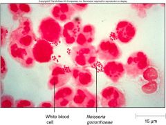 as a gram (-) diplococcus



found on and w/n leukocytes (neutrophils)
