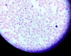 What form are these protozoa in inside the red blood cells and inside the plasma?