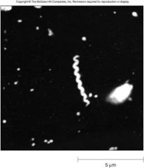 Treponema pallidum- motile spirochete



id: dark field microscopy or fluorescent staining