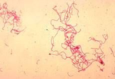 Haemophilus ducreyi


 


--> gram (-) bacillus, produces cytolethal, distending toxin


 